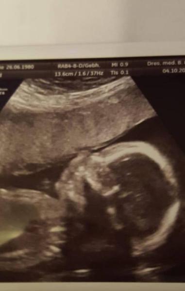 Bild zu Ultraschall - Forum für Februar - Mamis