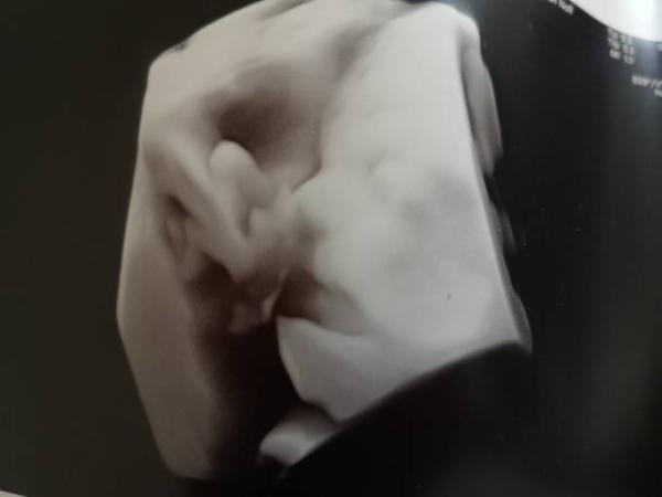 Bild zu FA Termin - Forum für Februar - Mamis