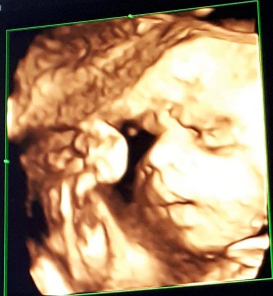 Bild zu FA Termin und 3. Ultraschall - Forum für Februar - Mamis