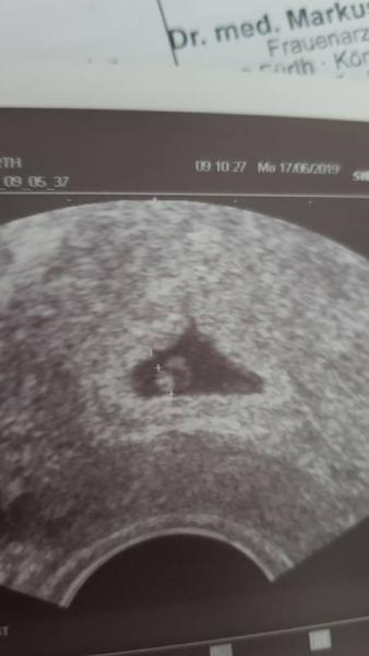 Bild zu Spitze Fruchthöhle - Forum für Februar - Mamis