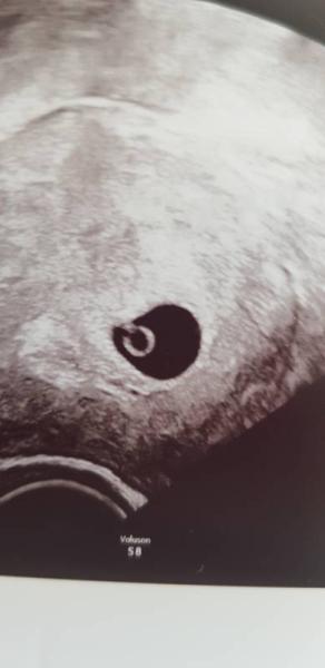 Bild zu Hilfe! Zurück datiert. Schaut mal bitte - Forum für Februar - Mamis