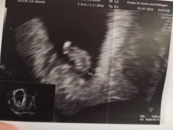 Bild zu Herzchen schlägt - Forum für Februar - Mamis
