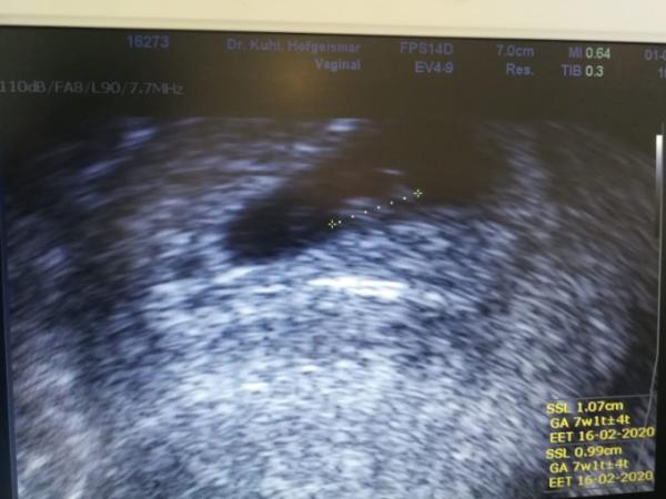 Bild zu 2. FA Termin bei 7+1 - Forum für Februar - Mamis