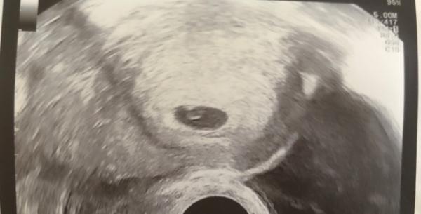 Bild zu 2 FA Termin - Forum für Februar - Mamis