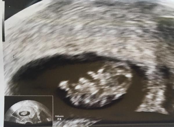 Bild zu Soooo erleichtert!!! - Forum für Februar - Mamis
