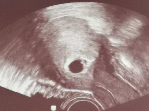 Bild zu So, zurück vom FA - Forum für Februar - Mamis