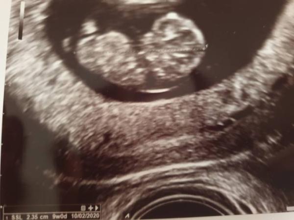 Bild zu Beruhigt und glücklich nach FA Termin - Forum für Februar - Mamis