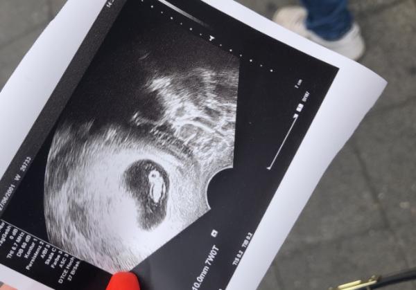 Bild zu Zurück vom 1.FAT - Forum für Februar - Mamis