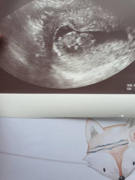 Bild zu 11 ssw. - Forum für Februar - Mamis