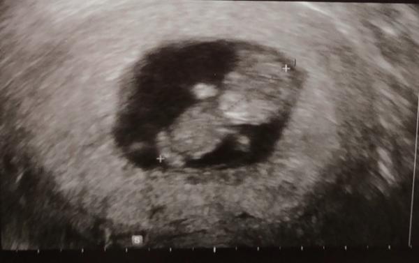 Bild zu Bedenken unbegründet - Forum für Februar - Mamis
