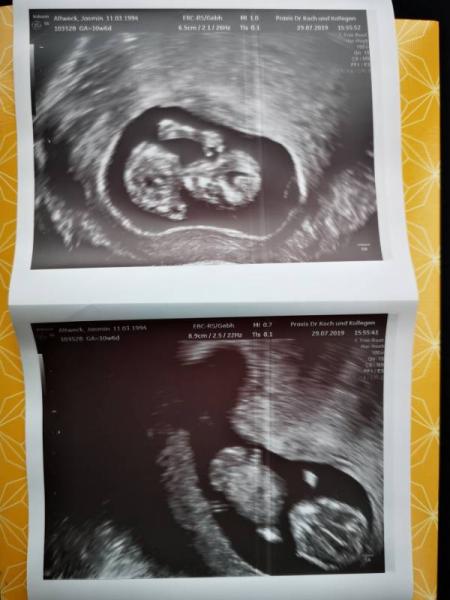 Bild zu Erleichtert.. - Forum für Februar - Mamis