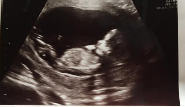 Bild zu Happy - Forum für Februar - Mamis