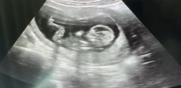 Bild zu Bin so happy! Bauchbewohner wohl auf 💕 - Forum für Februar - Mamis