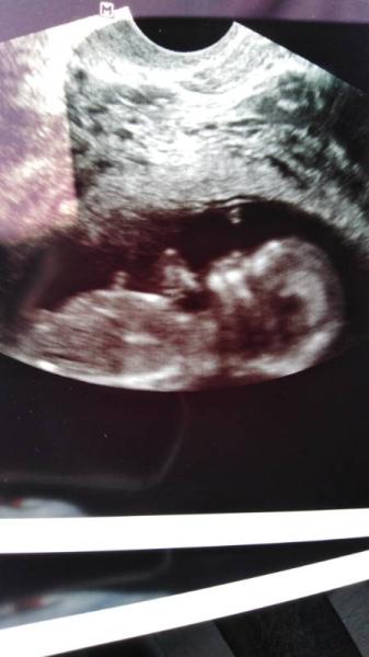 Bild zu Und doch vaginal... - Forum für Februar - Mamis
