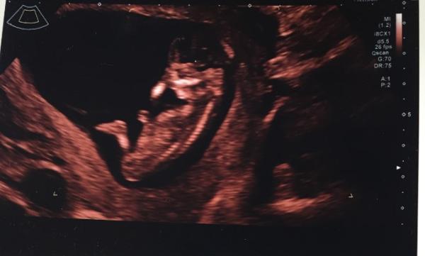 Bild zu Bildchen vom US 😊 - Forum für Februar - Mamis