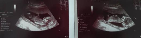 Bild zu Zurück vom FA... - Forum für Februar - Mamis