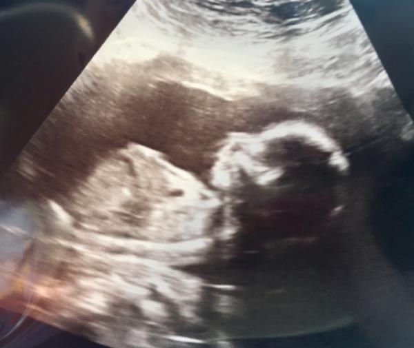 Bild zu Team.... - Forum für Februar - Mamis