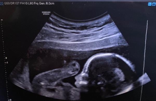 Bild zu 2. großer Ultraschall - Forum für Februar - Mamis
