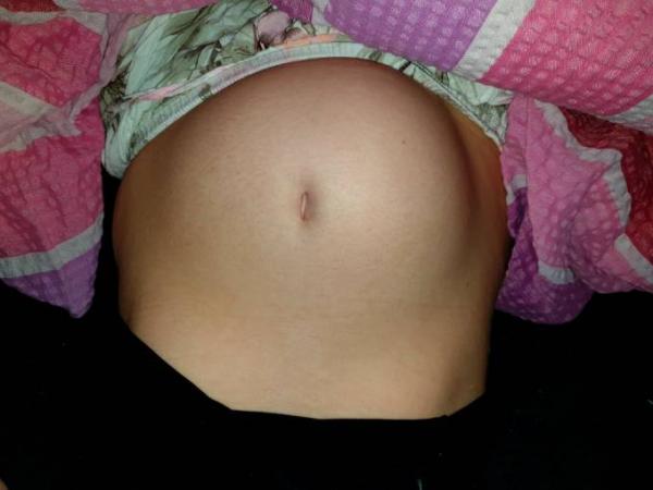Bild zu Beckenringlockerung? - Forum für Februar - Mamis