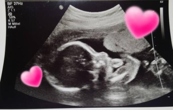 Bild zu Heute Feindiagnostik und klares Outing 😍 - Forum für Februar - Mamis