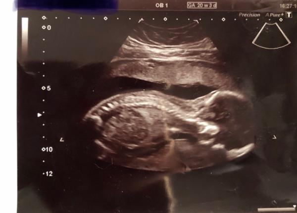 Bild zu Wer möchte mit mir das Geschlecht raten 😊 - Forum für Februar - Mamis