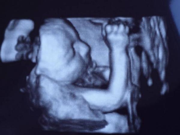 Bild zu Gewichtszunahme + Zuckertest + 3d Ultraschall - Forum für Februar - Mamis