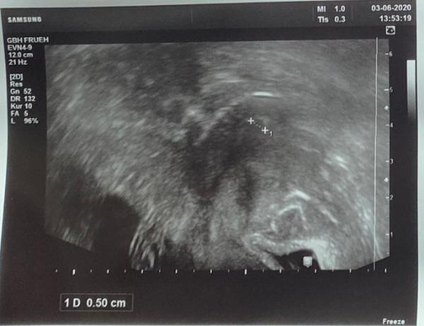 Bild zu 1. Termin beim FA :) - Forum für Februar - Mamis