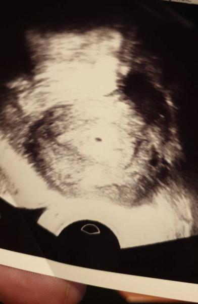 Bild zu Ängstlich... - Forum für Februar - Mamis