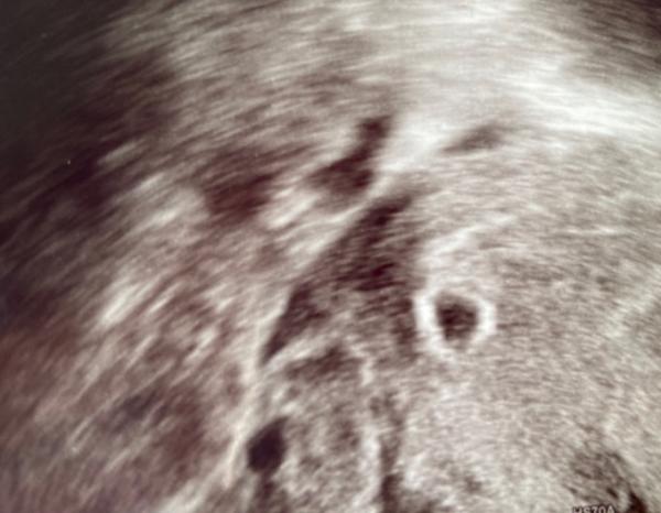 Bild zu 1. Gyn-Termin - Forum für Februar - Mamis