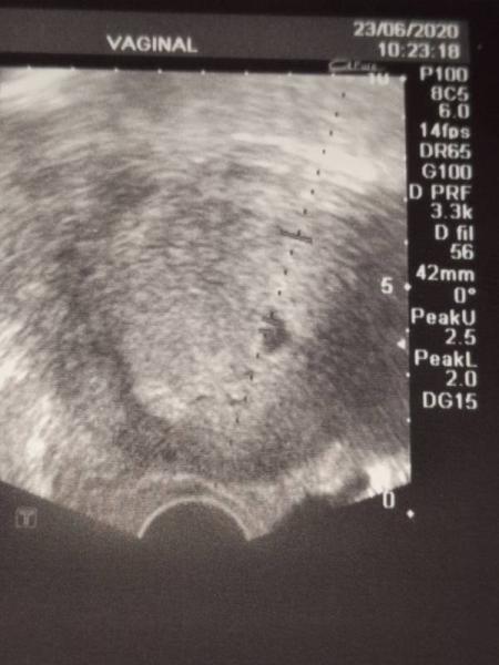 Bild zu Frauenarzt termin  - Forum für Februar - Mamis