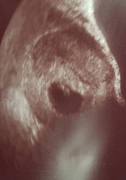 Bild zu 1. Termin beim Gyn - Forum für Februar - Mamis