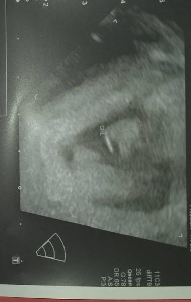 Bild zu Ich ziehe weiter in den März - Forum für Februar - Mamis