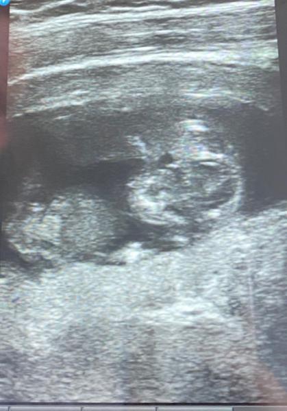 Bild zu Ultraschall selbst gemacht - Forum für Februar - Mamis