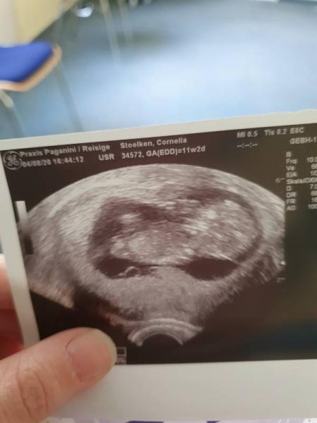 Bild zu Spontaner Besuch beim Frauenarzt - Forum für Februar - Mamis