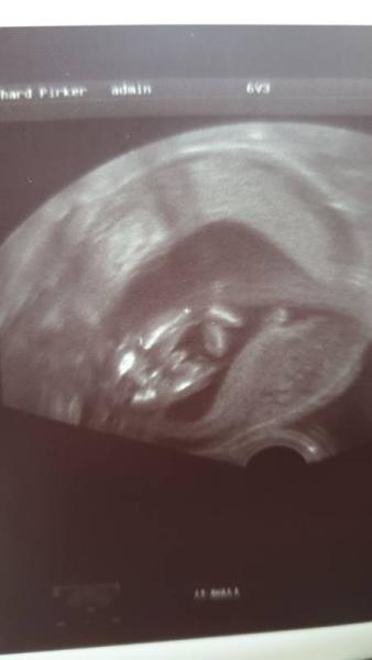 Bild zu Junge oder Mädchen? - Forum für Februar - Mamis