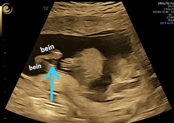 Bild zu Könnt ihr da was sehen? - Forum für Februar - Mamis