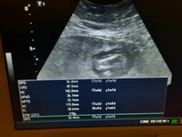 Bild zu Zurück vom Frauenarzt bisschen enttäuscht 😞 - Forum für Februar - Mamis