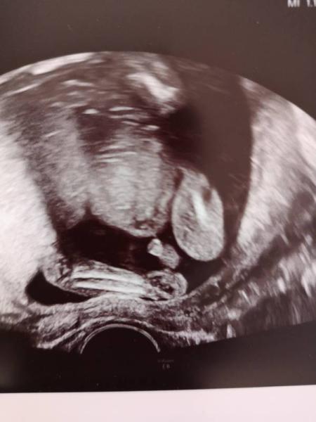 Bild zu Eindeutig Junge? - Forum für Februar - Mamis