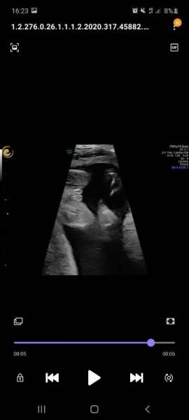 Bild zu Its a.... - Forum für Februar - Mamis
