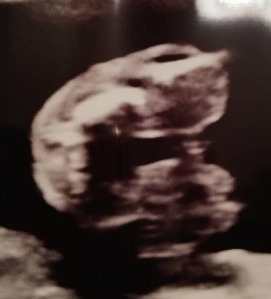 Bild zu 2. Großer Ultraschall and it's a... - Forum für Februar - Mamis