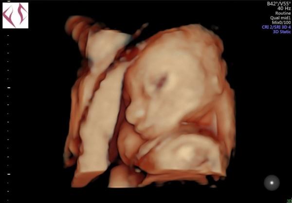 Bild zu Ultraschall und Glucosetest - Forum für Februar - Mamis