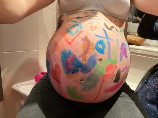 Bild zu 