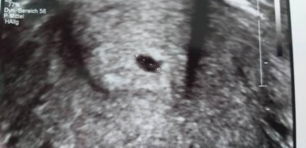 Bild zu 1. Termin bei FA. 5+2 und guter Hoffnung - Forum für Februar - Mamis