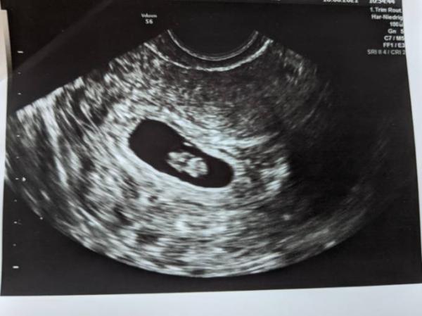 Bild zu Erster Termin :) - Forum für Februar - Mamis