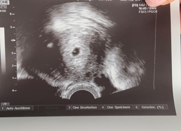 Bild zu Update, war beim Vertretungsarzt - Forum für Februar - Mamis