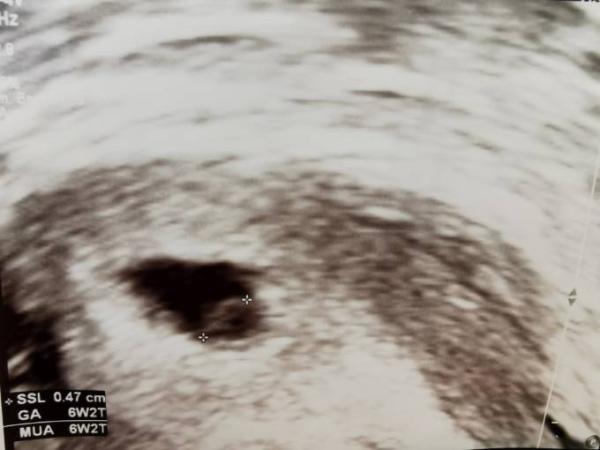 Bild zu Fa Termin - Forum für Februar - Mamis