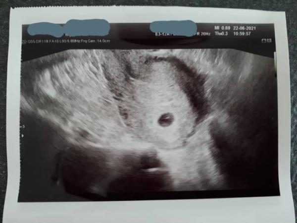 Bild zu 1. Termin ❤ - Forum für Februar - Mamis