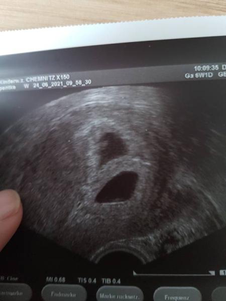 Bild zu 1. US an 6+1 - Forum für Februar - Mamis