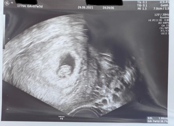 Bild zu Erster Termin - Forum für Februar - Mamis
