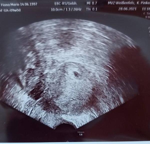 Bild zu Verängstigt.. - Forum für Februar - Mamis